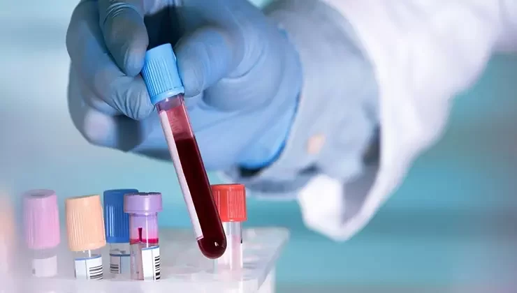 Nova terapia genética traz esperança no combate ao Alzheimer